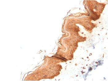 Anti-Cytokeratin 4 (KRT4) Monoclonal Antibody(Clone: KRT4/2804)