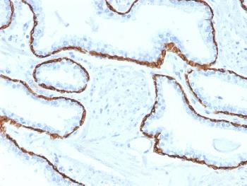 Anti-Cytokeratin 5 (KRT5) (Basal, Myoepithelial & Mesothelial Cell Marker) Monoclonal Antibody(Clone: KRT5/2080)