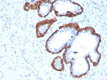 Anti-Cytokeratin 5 (KRT5) (Basal, Myoepithelial & Mesothelial Cell Marker) Monoclonal Antibody(Clone: KRT5/3594)