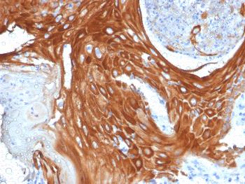 Anti-Cytokeratin 6A (KRT6A) (Basal Cell Marker) Monoclonal Antibody(Clone: KRT6A/2368)