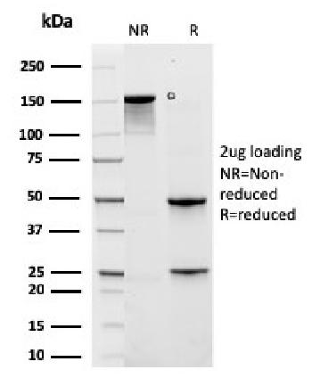 Anti-Cytokeratin 6A (KRT6A) (Basal Cell Marker) Monoclonal Antibody(Clone: rKRT6A/2100)