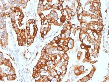 Anti-Cytokeratin 7 (Glandular and Transitional Epithelial Marker) Monoclonal Antibody(Clone: KRT7/2200)