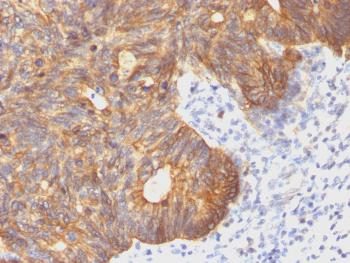 Anti-Cytokeratin 8 (KRT8) Monoclonal Antibody(Clone: C-43)