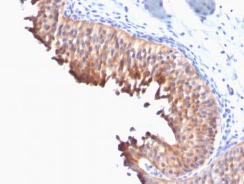 Anti-Cytokeratin 10 (Suprabasal Epithelial Marker) Monoclonal Antibody(Clone: DE-K10)