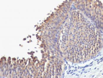 Anti-Cytokeratin 10 (Suprabasal Epithelial Marker) Monoclonal Antibody(Clone: SPM623)