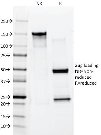 Anti-Cytokeratin 10 (Suprabasal Epithelial Marker) Monoclonal Antibody(Clone: AE20)