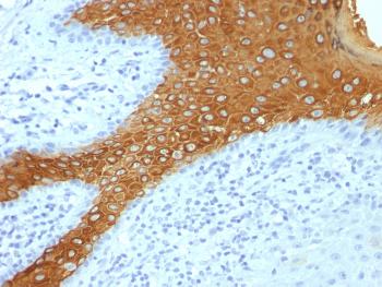 Anti-Cytokeratin 10 (Suprabasal Epithelial Marker) Monoclonal Antibody(Clone: KRT10/844 + KRT10/1275)