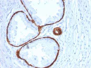 Anti-Cytokeratin 14 (KRT14) (Squamous Cell Marker) Monoclonal Antibody(Clone: KRT14/2375)