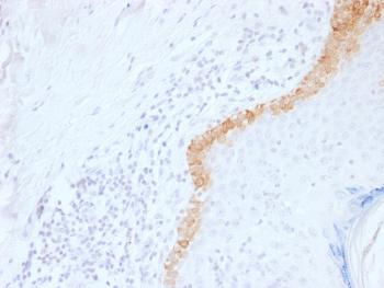 Anti-Cytokeratin 15 (Esophageal Squamous Cell Carcinoma Marker) Monoclonal Antibody(Clone: LHK15)