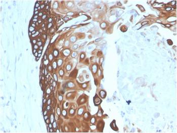 Anti-Cytokeratin 15 (Esophageal Squamous Cell Carcinoma Marker) Monoclonal Antibody(Clone: SPM190)