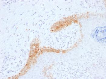 Anti-Cytokeratin 15 (Esophageal Squamous Cell Carcinoma Marker) Monoclonal Antibody(Clone: KRT15/1699)