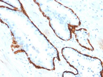 Anti-Cytokeratin 15 (Esophageal Squamous Cell Carcinoma Marker) Monoclonal Antibody(Clone: KRT15/2554)