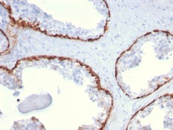 Anti-Cytokeratin 15 (Esophageal Squamous Cell Carcinoma Marker) Monoclonal Antibody(Clone: KRT15/2959)