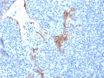 Anti-Cytokeratin 16 (KRT16) (Suprabasal Keratinocyte Marker) Monoclonal Antibody(Clone: LL025)