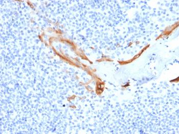 Anti-Cytokeratin 16 (KRT16) (Suprabasal Keratinocyte Marker) Monoclonal Antibody(Clone: SPM264)