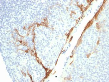 Anti-Cytokeratin 16 (KRT16) (Suprabasal Keratinocyte Marker) Monoclonal Antibody(Clone: rKRT16/1714)