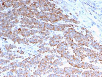 Anti-Cytokeratin 18 (KRT18) Monoclonal Antibody(Clone: rKRT18/1190)