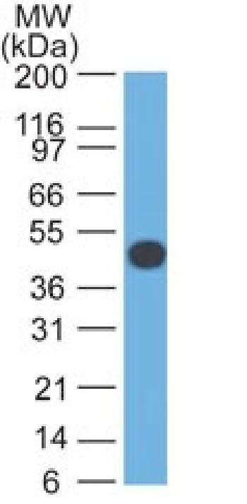 Anti-Cytokeratin 18 (KRT18) Monoclonal Antibody(Clone: DA7)