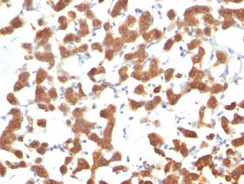 Anti-Cytokeratin 18 (KRT18) Monoclonal Antibody(Clone: C-04; same as Ks18.04)