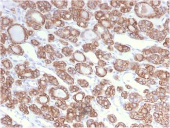 Anti-Cytokeratin 18 (KRT18) Monoclonal Antibody(Clone: KRT18/2808R)