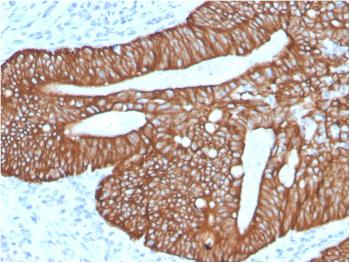 Anti-Cytokeratin 18 (KRT18) Monoclonal Antibody(Clone: KRT18/2819R)