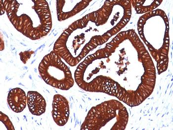 Anti-Cytokeratin 19 (KRT19) (Pancreatic Stem Cell Marker) Monoclonal Antibody(Clone: BA17)