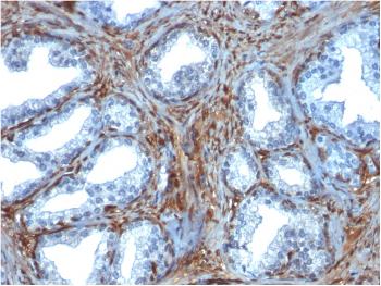 Anti-Galectin-1 / Human Placental Lactogen (hPL) Monoclonal Antibody(Clone: GAL1/1831)