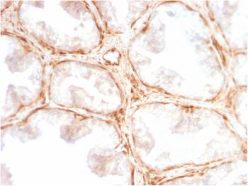 Anti-Galectin-1 / Human Placental Lactogen (hPL) Monoclonal Antibody(Clone: GAL1/2499R)