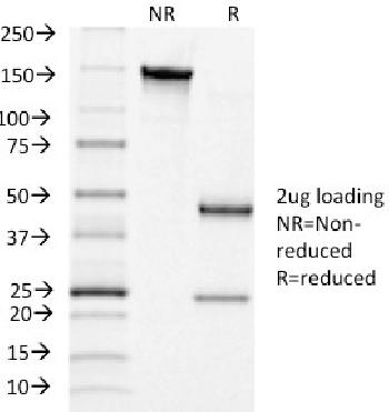 Anti-Luteinizing Hormone / Choriogonadotropin Receptor (LHCGR) Monoclonal Antibody(Clone: LHCGR/1415)