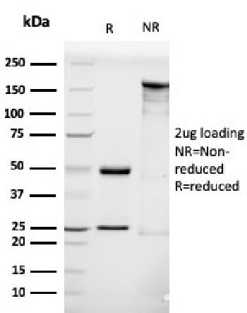 Anti-Luteinizing Hormone / Choriogonadotropin Receptor (LHCGR) Monoclonal Antibody(Clone: LHCGR/1416)