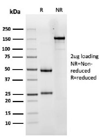 Anti-Luteinizing Hormone / Choriogonadotropin Receptor (LHCGR) Monoclonal Antibody(Clone: LHCGR/1417)