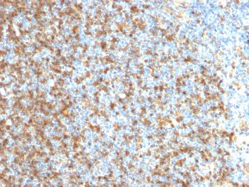 Anti-LMO2 (B-Cell Marker) Monoclonal Antibody(Clone: LMO2/1971)