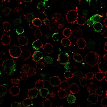 Anti-LMO2 (B-Cell Marker) Monoclonal Antibody(Clone: LMO2/3147R)