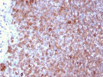 Anti-Lymphocyte Specific Protein 1 (LSP1) / pp52 Monoclonal Antibody(Clone: LSP1/3025)