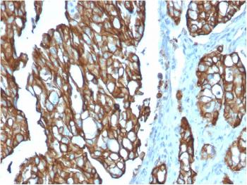 Anti-TACSTD2 / TROP2 (Epithelial Marker) Monoclonal Antibody(Clone: TACSTD2/2151)