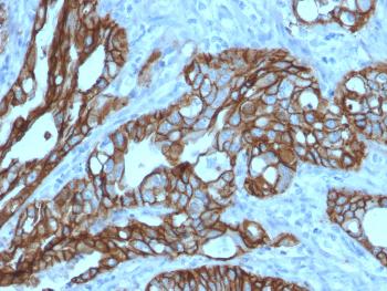 Anti-TACSTD2 / TROP2 (Epithelial Marker) Monoclonal Antibody(Clone: TACSTD2/2152)