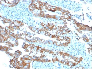 Anti-TACSTD2 / TROP2 (Epithelial Marker) Monoclonal Antibody(Clone: TACSTD2/2153)