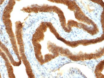 Anti-Ep-CAM / CD326 (Extracellular Domain) (Epithelial Marker) Monoclonal Antibody(Clone: VU-1D9)