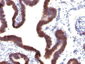 Anti-Ep-CAM / CD326 (Extracellular Domain) (Epithelial Marker) Monoclonal Antibody(Clone: EGP40/1120)