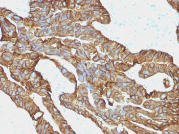 Anti-Ep-CAM / CD326 (Extracellular Domain) (Epithelial Marker) Monoclonal Antibody(Clone: EGP40/1372)