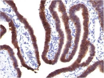 Anti-Ep-CAM / CD326 (Extracellular Domain) (Epithelial Marker) Monoclonal Antibody(Clone: EGP40/1373)