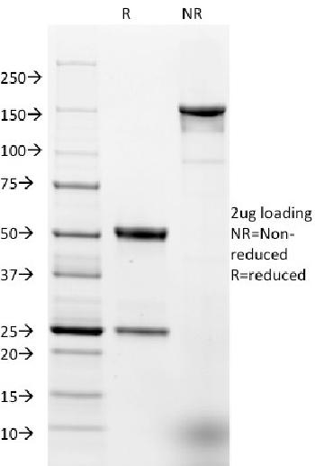 Anti-Ep-CAM / CD326 (Extracellular Domain) (Epithelial Marker) Monoclonal Antibody(Clone: EGP40/1384)