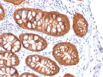 Anti-Ep-CAM / CD326 (Extracellular Domain) (Epithelial Marker) Monoclonal Antibody(Clone: rVU-1D9)