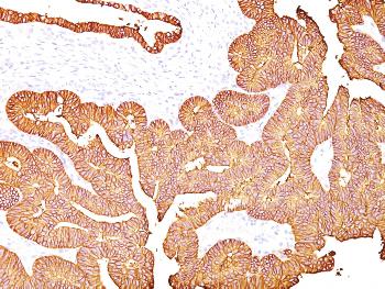 Anti-Ep-CAM / CD326 (Extracellular Domain) (Epithelial Marker) Monoclonal Antibody(Clone: 323/A3)