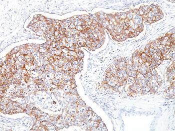 Anti-Ep-CAM / CD326 (Extracellular Domain) (Epithelial Marker) Monoclonal Antibody(Clone: Ber-EP4)