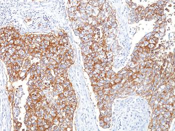 Anti-Ep-CAM / CD326 (Extracellular Domain) (Epithelial Marker) Monoclonal Antibody(Clone: HEA125)