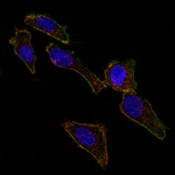 Anti-Ep-CAM / CD326 (Extracellular Domain) (Epithelial Marker) Monoclonal Antibody(Clone: EGP40/826)-CF488