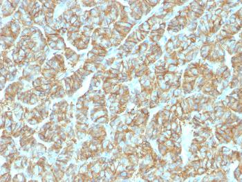 Anti-Ep-CAM / CD326 (Extracellular Domain) (Epithelial Marker) Monoclonal Antibody(Clone: EGP40/1555R)