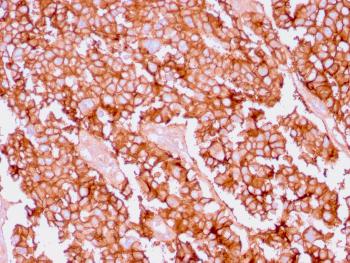 Anti-Ep-CAM / CD326 (Extracellular Domain) (Epithelial Marker) Monoclonal Antibody(Clone: EGP40/1556R)