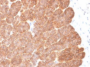 Anti-Ep-CAM / CD326 (Extracellular Domain) (Epithelial Marker) Monoclonal Antibody(Clone: EGP40/2041R)